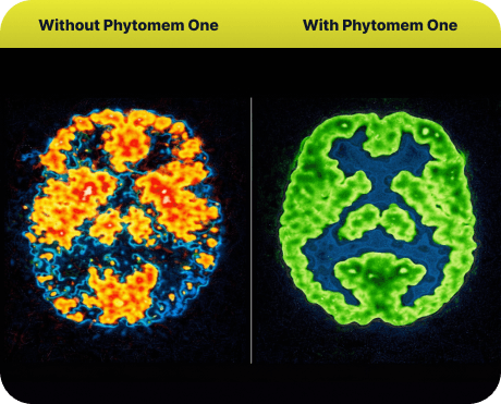 Phytomem One before and after brain clarity comparison